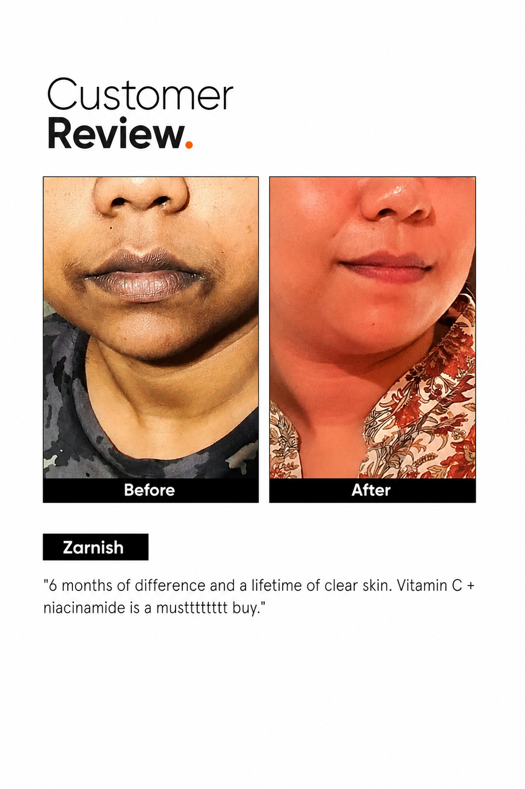 Niacinamide 10% Face Serum