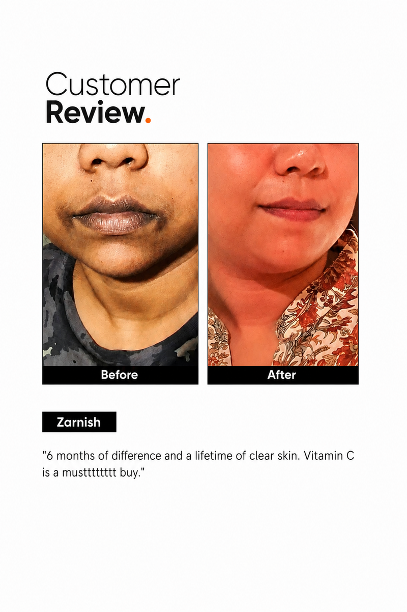Vitamin C 10% Face Serum